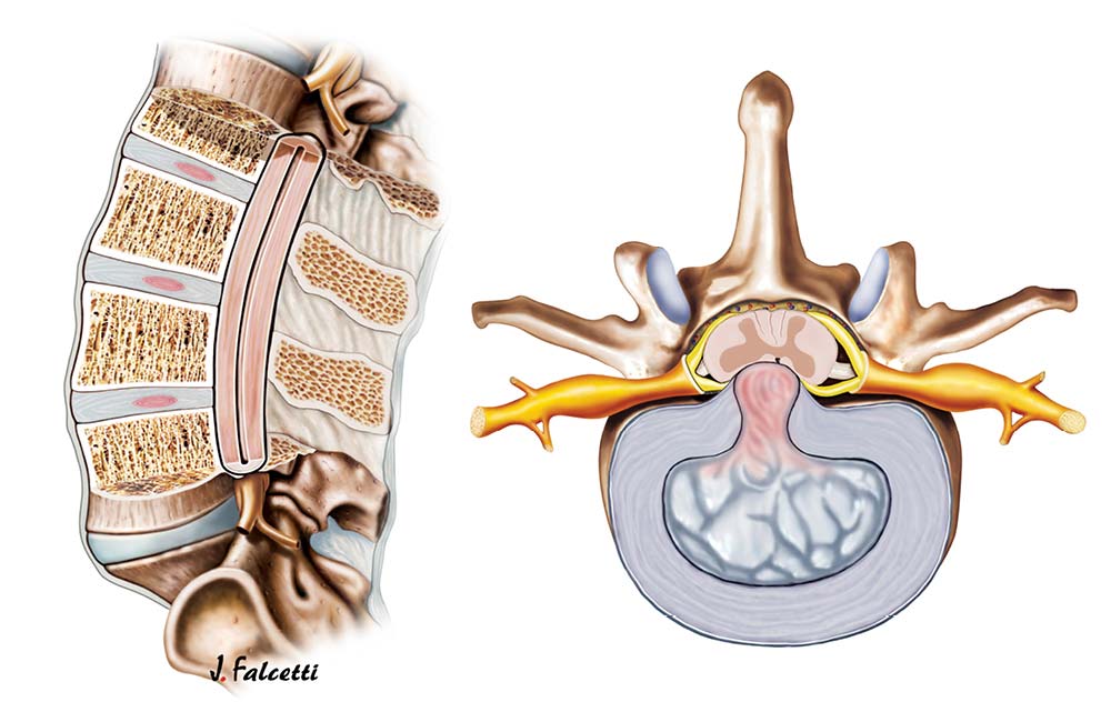 Healthy back Modern Mayr Medicine